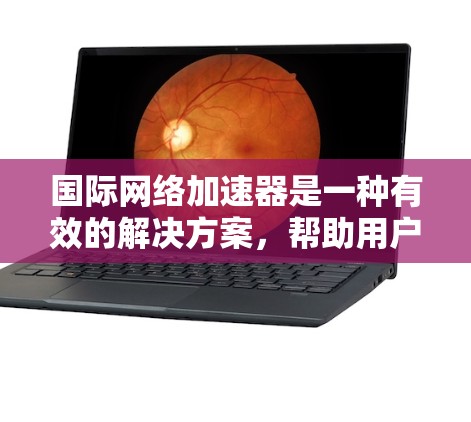 国际网络加速器是一种有效的解决方案,帮助用户快速访问国外网站,缓解延迟问题。以下是对国际网络加速器的详细分析和使用建议 国际网络加速器是一种有效的解决方案,帮助用户快速访问国外网站,缓解延迟问题。以下是对国际网络加速器的详细分析和使用建议